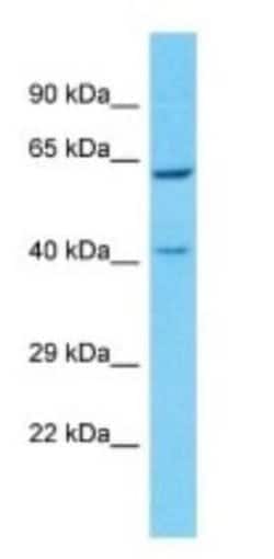 Pregnancy Specific beta-1-glycoprotein 8 Rabbit anti-Human, Polyclonal,